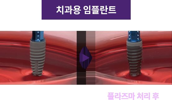 플라즈마 표면 처리 전후 픽스처 표면 모식도