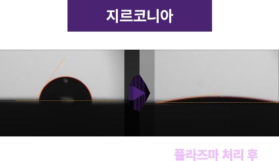 지르코니아 크라운 표면 모습